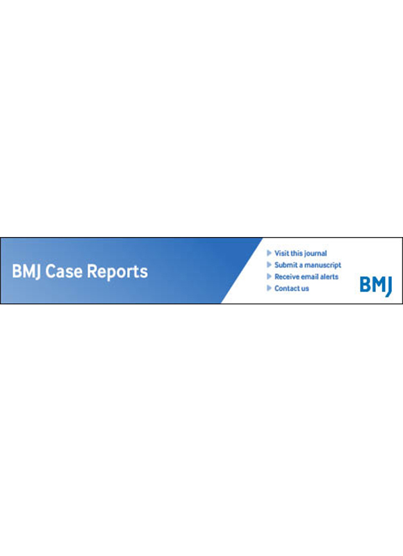 Bmj 病例報告